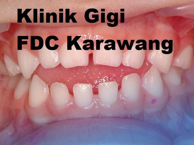 fdc karawang