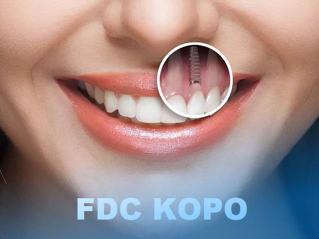 fdc kopo