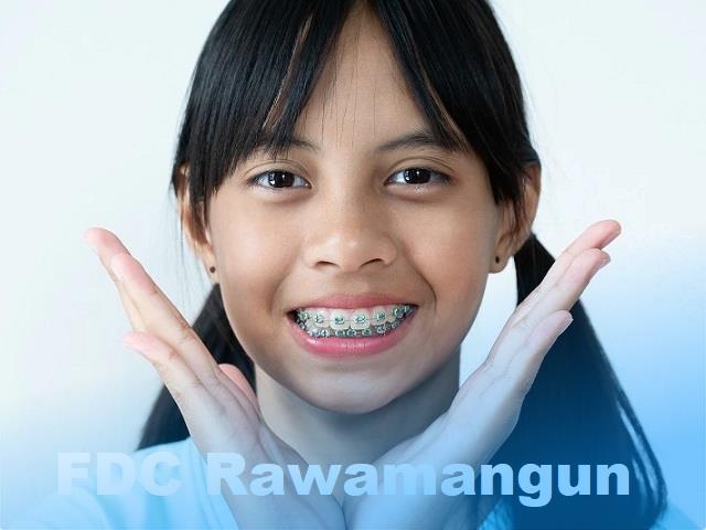 fdc rawamangun