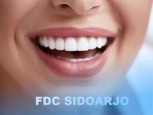 fdc sidoarjo