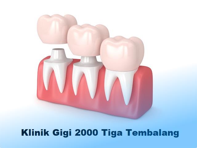 Klinik Gigi 2000 Tiga Tembalang